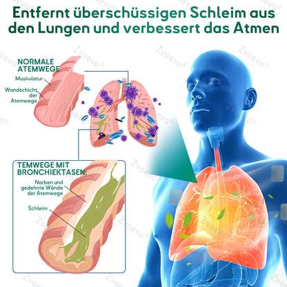 🎈✅Offizieller Store: 𝐙𝐯𝐨𝐞𝐯𝐨® 𝐃𝐨𝐮𝐛𝐥𝐞𝐍𝐚𝐧𝐨 𝐅𝐨𝐫𝐭𝐬𝐜𝐡𝐫𝐢𝐭𝐭𝐥𝐢𝐜𝐡𝐞𝐬 𝐋𝐮𝐧𝐠𝐞𝐧𝐞𝐧𝐭𝐠𝐢𝐟𝐭𝐮𝐧𝐠𝐬-𝐏𝐟𝐥𝐚𝐬𝐭𝐞𝐫 𝐳𝐮𝐫 𝐋𝐢𝐧𝐝𝐞𝐫𝐮𝐧𝐠(💝 LETZTER TAG 50% RABATT 💝)