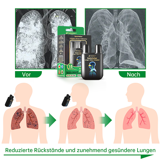 🐶✅Offizieller Shop|🔥Furzero™ Natürlicher Lungen-Detox-Inhalator(💝LETZTER TAG 50% RABATT 💝)