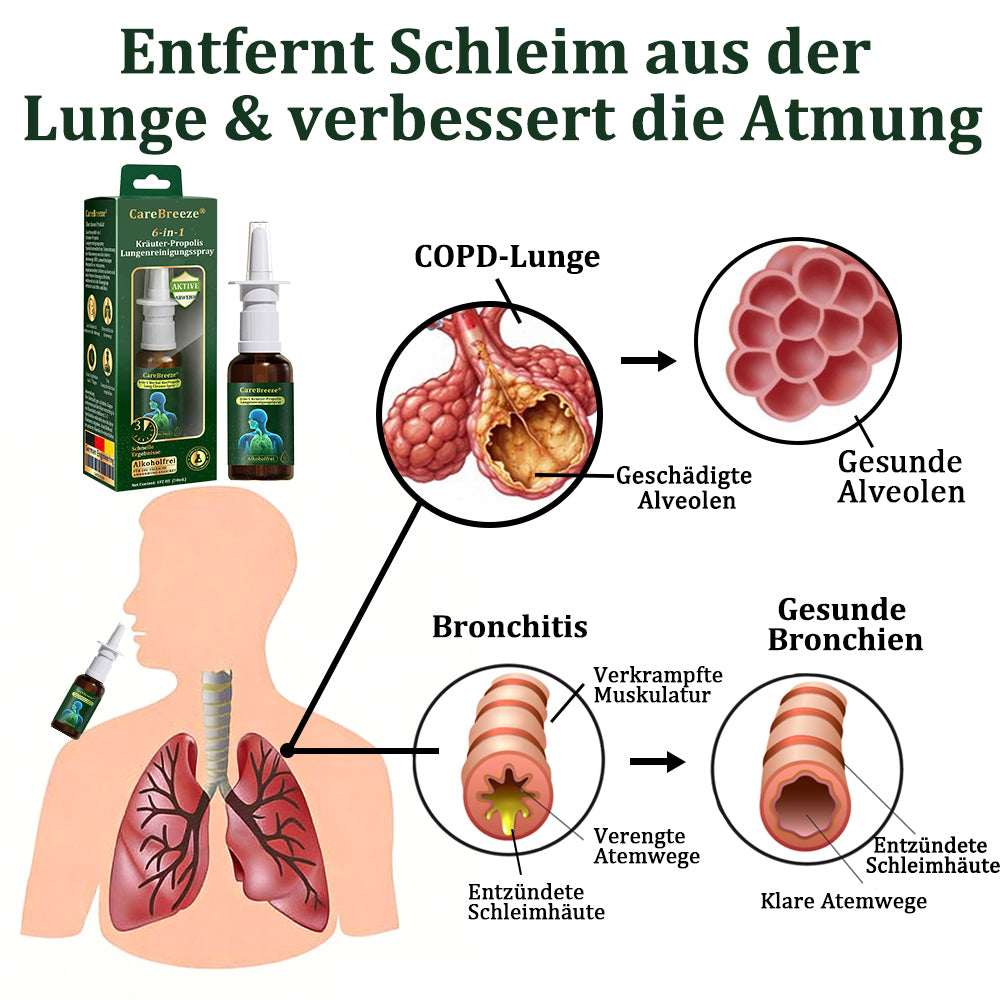 ⚡🇩🇪 Offizieller Store：CareBreeze® 6-in-1 Kräuter-Propolis Lungenreinigungsspray-Feinzerstäubung(⚡Sofortige Linderung🫁Langzeitwirkungen)