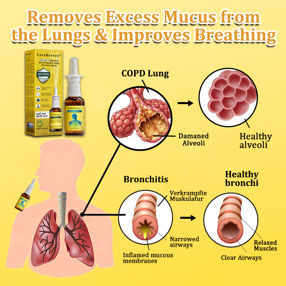 ⚡🐝✅Offizieller Store：CareBreeze® 6-in-1 Kräuter-Propolis Lungenreinigungsspray（👨‍⚕️Gezielte Anwendung bei COPD, Asthma, chronischer Bronchitis, Infektionen der Atemwege, Lungenkrebs und Sinusitis）