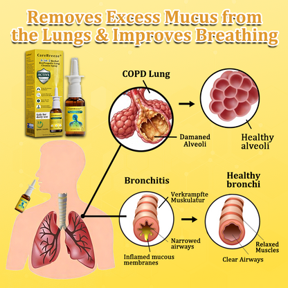 ⚡🐝✅Offizieller Store：CareBreeze® 6-in-1 Kräuter-Propolis Lungenreinigungsspray（👨‍⚕️Gezielte Anwendung bei COPD, Asthma, chronischer Bronchitis, Infektionen der Atemwege, Lungenkrebs und Sinusitis）