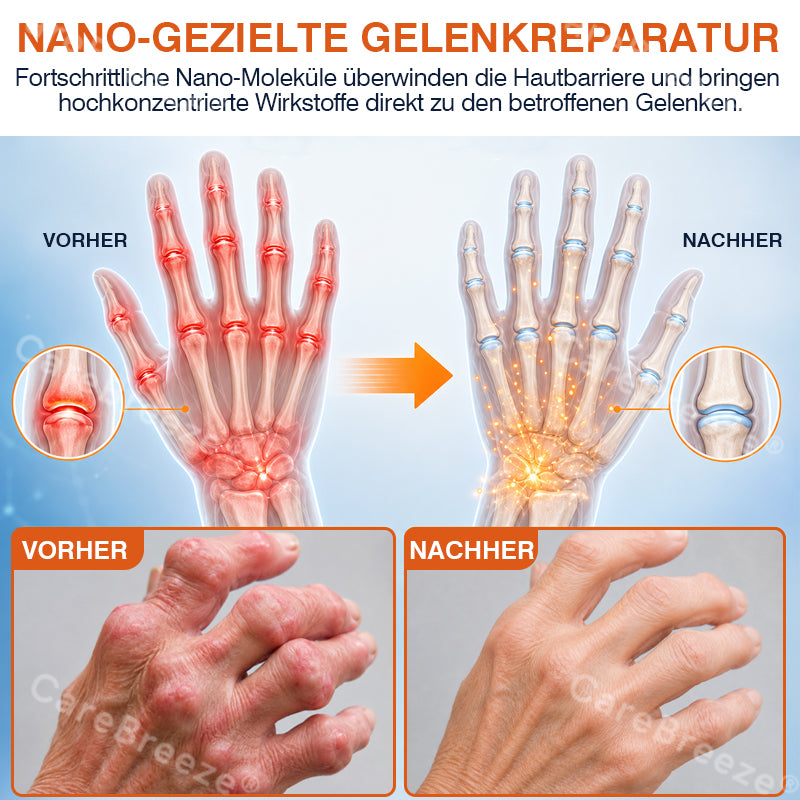 💝✅🇩🇪 CareBreeze® Mikronadel-Pflaster zur Schmerzlinderung und Knochenheilung(🧑‍⚕️ Linderung von Gelenkschwellungen, Schmerzen, Steifheit, Rötungen, Wärmegefühl, Druckempfindlichkeit und Gelenkermüdung)