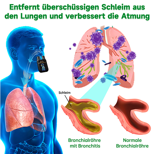 💖Offizieller Shop|🔥Furzero™ Natürlicher Lungen-Detox-Inhalator(💝LETZTER TAG 50% RABATT 💝)
