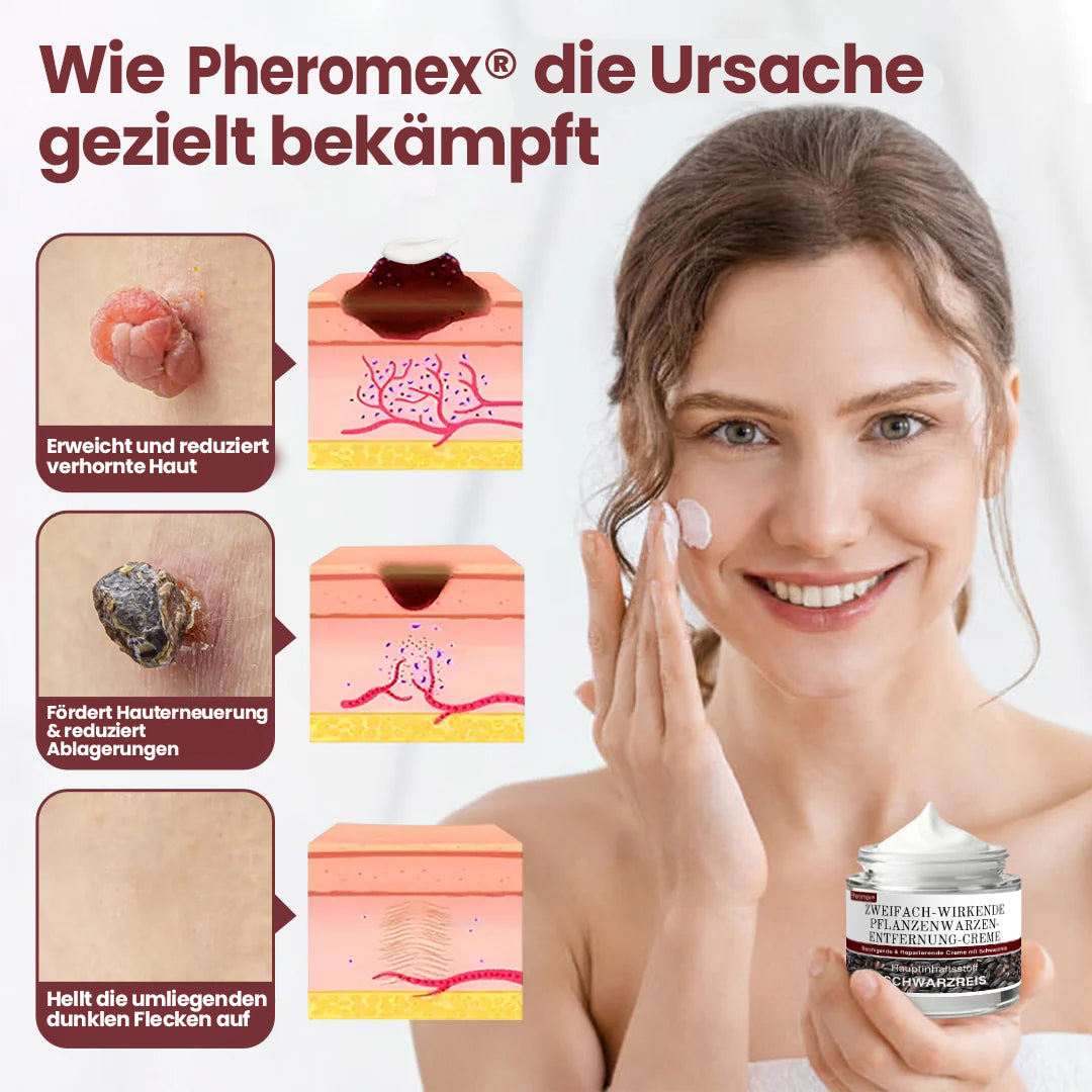 💖💖✅Pheromex® Zweifach-Wirkende Pflanzenwarzenentfernung-Creme(👨‍⚕️Hautwarzen, Akne, Hyperpigmentierung, Ekzem, Psoriasis, Rosazea, Warzen)