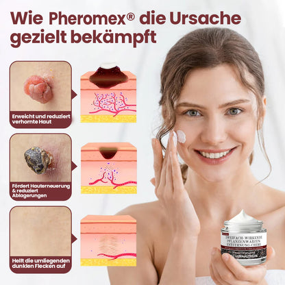 💖💖✅Pheromex® Zweifach-Wirkende Pflanzenwarzenentfernung-Creme(👨‍⚕️Hautwarzen, Akne, Hyperpigmentierung, Ekzem, Psoriasis, Rosazea, Warzen)