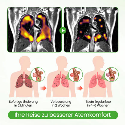 ✅Deutscher Besitz und Betrieb：CareBreeze® Botanischer Mullein Lungenreinigungsdiffusor(💝 LETZTER TAG 70% RABATT 💝)