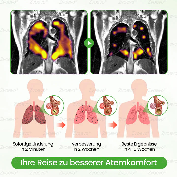 💖✅Deutscher Besitz und Betrieb：Zvoevo® Botanischer Mullein Lungenreinigungsdiffusor (💝 Husten, Keuchen, Atemnot, Auswurf, verstopfte Nase, Bronchitis, Allergiesymptome, Lungenschmerzen 💝)