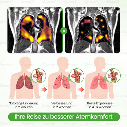 💖✅Deutscher Besitz und Betrieb：Zvoevo® Botanischer Mullein Lungenreinigungsdiffusor (💝 Husten, Keuchen, Atemnot, Auswurf, verstopfte Nase, Bronchitis, Allergiesymptome, Lungenschmerzen 💝)
