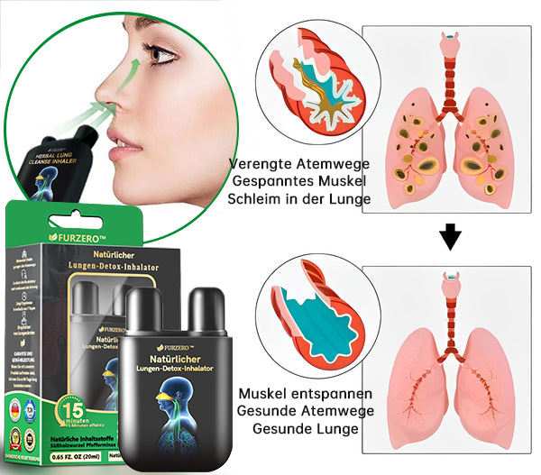 🐶✅Offizieller Shop|🔥Furzero™ Natürlicher Lungen-Detox-Inhalator(💝LETZTER TAG 50% RABATT 💝)