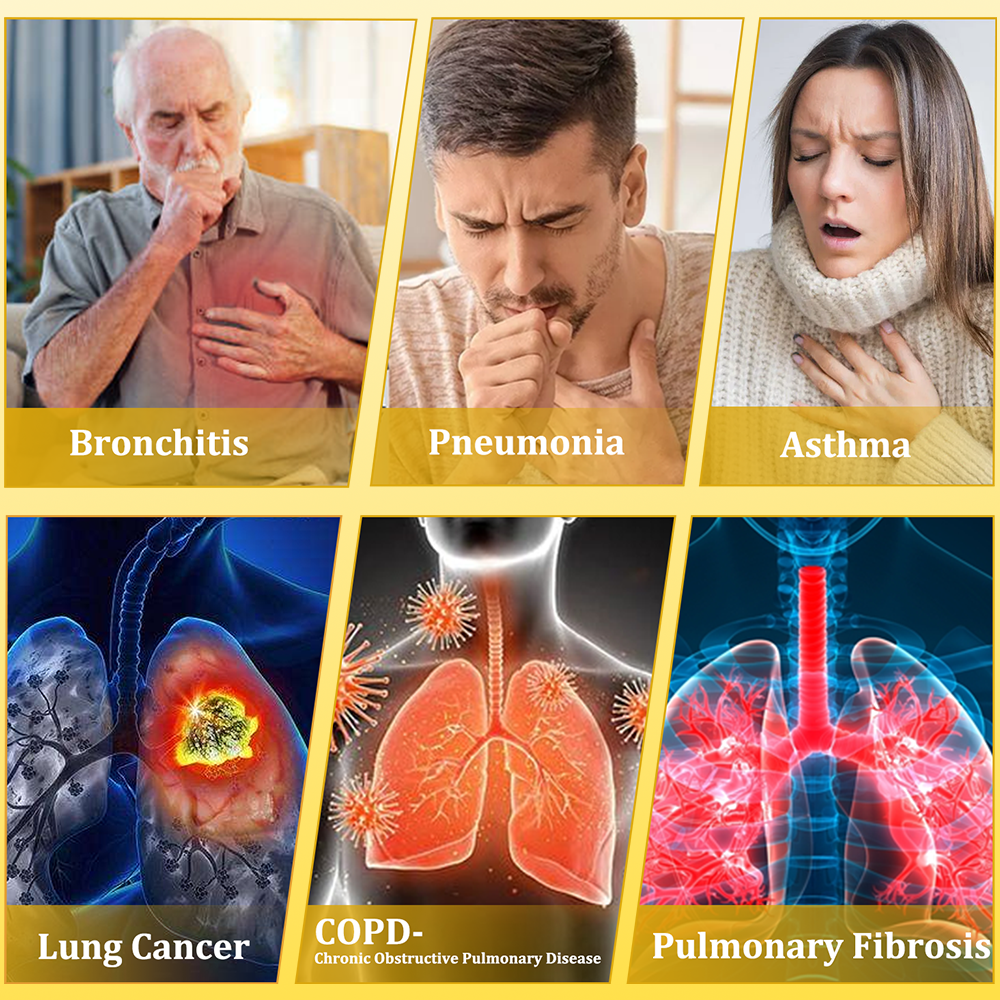 ⚡🐝✅Offizieller Store：CareBreeze® 6-in-1 Kräuter-Propolis Lungenreinigungsspray（👨‍⚕️Gezielte Anwendung bei COPD, Asthma, chronischer Bronchitis, Infektionen der Atemwege, Lungenkrebs und Sinusitis）